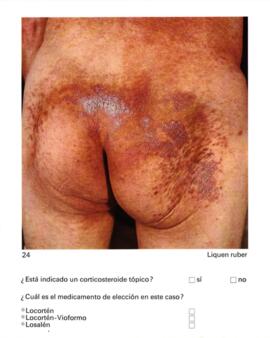 Afecciones alérgicas cutáneas